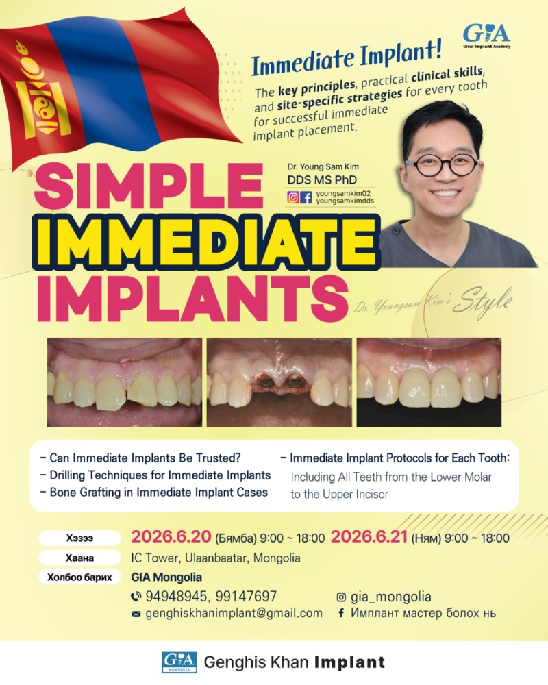 몽골-임플란트3강-(260620-0621).jpg