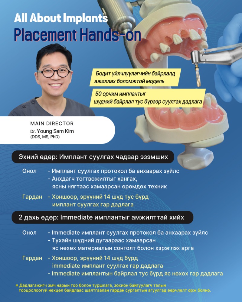 임플란트실습모든것(260731-0802)-몽골어_p2.jpg
